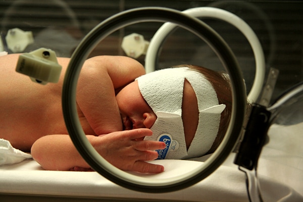 Jaundice phototherapy mama nurse breastfeeding newborn jaundice